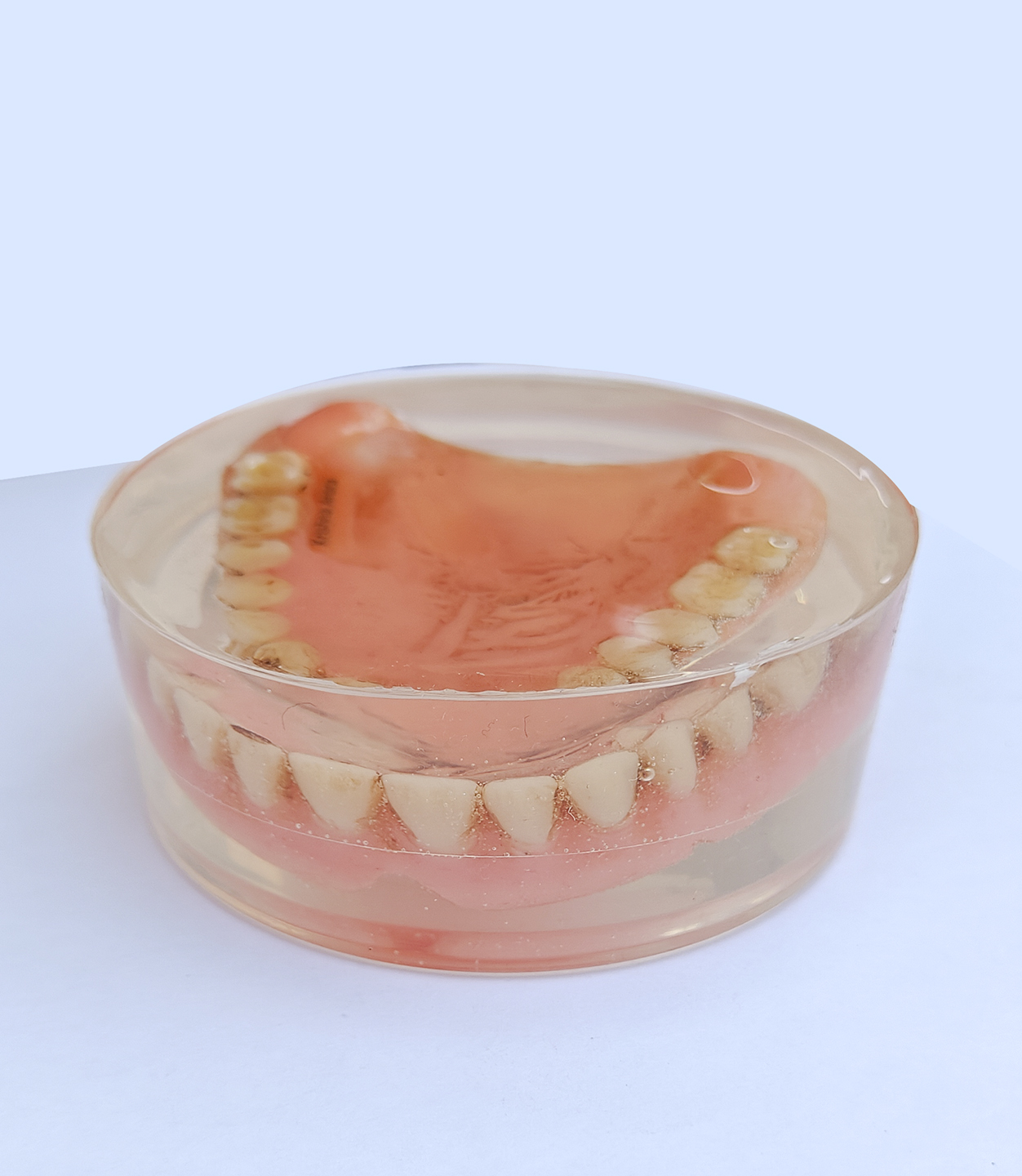  Ma's dentures which she couldn't use during the last four five months of her life